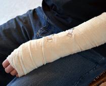 review-1-arm-B.jpg