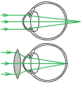 unit-5_ch-9_qn-263Exp_img_no1.png