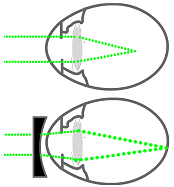 unit-5_ch-9_qn-400Exp_img_no1.png
